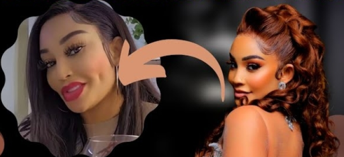 A New Dimple Appearance for Zari After Surgery!